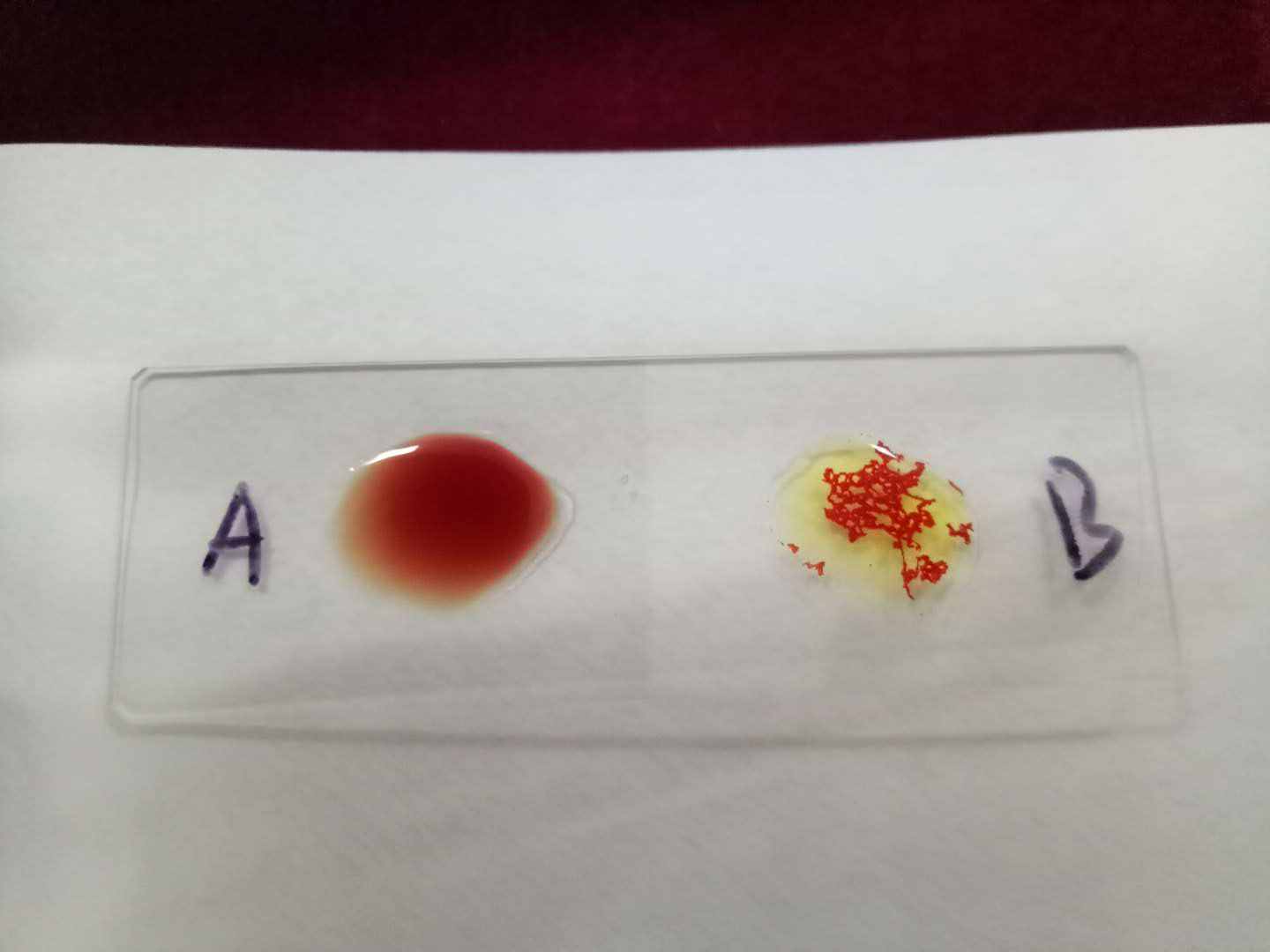 醫(yī)學(xué)檢驗(yàn)專(zhuān)業(yè)志愿者活動(dòng)